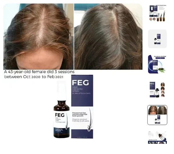 FEG Plus Organic Hair Growth Treatment Oil